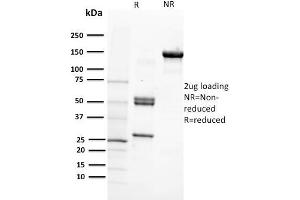 SDS-PAGE Analysis Purified CD29 Mouse Monoclonal Antibody (12G10). (ITGB1 anticorps)