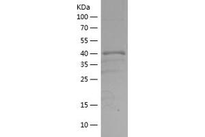 Western Blotting (WB) image for serine/threonine Kinase 11 (STK11) (AA 30-152) protein (His-IF2DI Tag) (ABIN7125040)