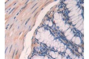 Detection of PON2 in Mouse Small intestine Tissue using Polyclonal Antibody to Paraoxonase 2 (PON2)