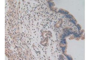 IHC-P analysis of Mouse Uterus Tissue, with DAB staining. (NUP85 anticorps  (AA 418-653))