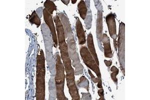 Immunohistochemical staining of human skeletal muscle with RWDD2B polyclonal antibody  shows strong cytoplasmic positivity in a heterogeneous staining pattern.