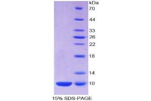 SDS-PAGE (SDS) image for S100 Calcium Binding Protein A7 (S100A7) (AA 1-101) protein (His tag) (ABIN1099442) (S100A7 Protein (AA 1-101) (His tag))