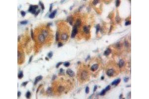 Used in DAB staining on fromalin fixed paraffin-embedded Stomach tissue (MUC5B anticorps  (AA 5366-5444))
