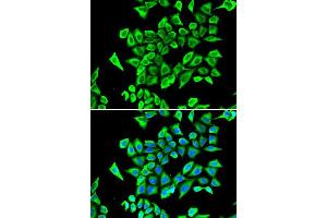 Immunofluorescence analysis of A549 cell using LCN2 antibody. (Lipocalin 2 anticorps  (AA 21-198))
