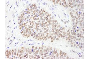 Immunohistochemistry (IHC) image for anti-PHD Finger Protein 6 (PHF6) (AA 315-365) antibody (ABIN7453758)