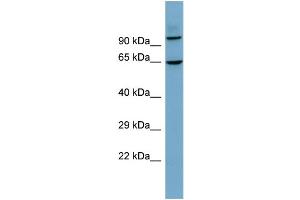 Host:  Rabbit  Target Name:  GALNTL6  Sample Type:  THP-1 Whole cell lysates  Antibody Dilution:  1. (GALNTL6 anticorps  (N-Term))