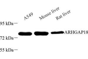 Western blot analysis of ARHGAP18 (ABIN7075417) at dilution of 1: 600 (ARHGAP18 anticorps)