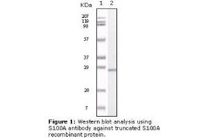 Image no. 2 for anti-S100 Calcium Binding Protein A1 (S100A1) antibody (ABIN232125) (S100A1 anticorps)