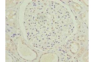Immunohistochemistry of paraffin-embedded human kidney tissue using ABIN7175021 at dilution of 1:100 (C5orf24 anticorps  (AA 7-188))