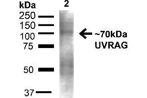 Western blot analysis of Rat Liver showing detection of ~70kDa UVRAG protein using Rabbit Anti-UVRAG Polyclonal Antibody . (UVRAG anticorps  (C-Term) (FITC))