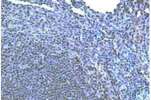 Immunohistochemistry (IHC) image for anti-Chemokine (C-C Motif) Receptor 10 (CCR10) antibody (ABIN2477947) (CCR10 anticorps)
