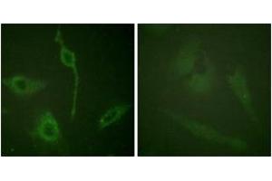 Immunofluorescence analysis of HeLa cells, using PDGFR alpha (Ab-762) Antibody. (PDGFRA anticorps  (AA 731-780))