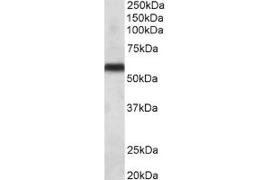 Western Blotting (WB) image for anti-Cytochrome P450, Family 2, Subfamily C, Polypeptide 8 (CYP2C8) antibody (ABIN5898160) (CYP2C8 anticorps)