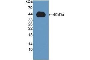 Detection of Recombinant MMP23B, Human using Polyclonal Antibody to Matrix Metalloproteinase 23B (MMP23B) (MMP23B anticorps  (AA 79-390))