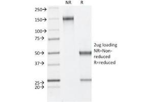 SDS-PAGE Analysis of Purified, BSA-Free Estrogen Receptor beta Antibody (clone ESR2/686). (ESR2 anticorps  (C-Term))