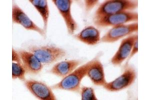 ICC testing of HeLa cells (CAPN1 anticorps  (Middle Region))