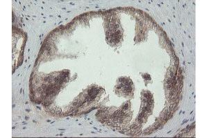 Image no. 1 for anti-Phosphoinositide-3-Kinase, Catalytic, gamma Polypeptide (PIK3CG) antibody (ABIN1500207)