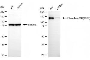 Western blotting analysis using phospho-p130 (T986) antibody (ABIN7799666). (Recombinant NOLC1 anticorps  (pThr986))
