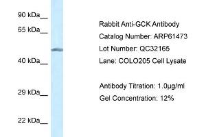 Western Blotting (WB) image for anti-Glucokinase (Hexokinase 4) (GCK) (N-Term) antibody (ABIN786429) (GCK anticorps  (N-Term))
