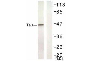 Image no. 1 for anti-Microtubule-Associated Protein tau (MAPT) (Ser422) antibody (ABIN197528) (MAPT anticorps  (Ser422))