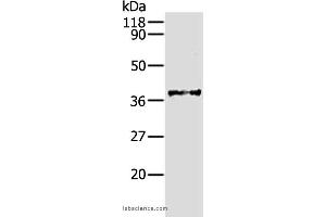 Western blot analysis of Hela cell, using AKR1B1 Polyclonal Antibody at dilution of 1:340 (AKR1B1 anticorps)