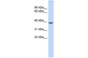 Western Blotting (WB) image for anti-DDB1 and CUL4 Associated Factor 4-Like 1 (DCAF4L1) antibody (ABIN2459760)