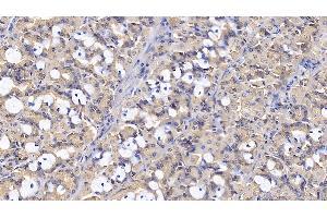 Detection of IL1RA in Human Stomach Tissue using Monoclonal Antibody to Interleukin 1 Receptor Antagonist (IL1RA)