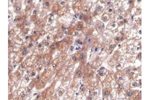 Detection of AFP in Human Liver Tissue using Monoclonal Antibody to Alpha-Fetoprotein (AFP)