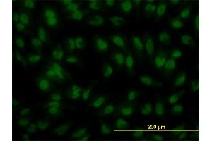 Immunofluorescence of monoclonal antibody to IRF2 on HeLa cell.