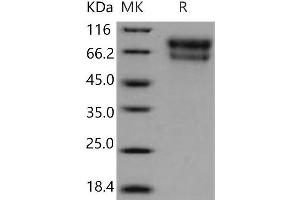 Western Blotting (WB) image for serpin Peptidase Inhibitor, Clade A (Alpha-1 Antiproteinase, Antitrypsin), Member 10 (SERPINA10) protein (His tag) (ABIN7320322)