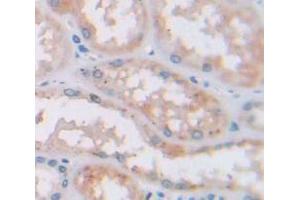 Used in DAB staining on fromalin fixed paraffin- embedded Kidney tissue