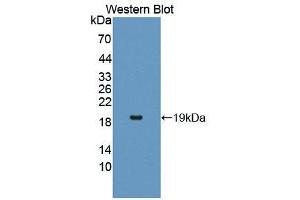 Western blot analysis of the recombinant protein. (IL17RA anticorps  (AA 377-534))