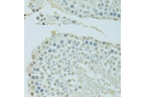 Immunohistochemistry of paraffin-embedded rat testis using BRD3 antibody (ABIN1678901, ABIN3015924, ABIN3015926 and ABIN6219475) at dilution of 1:100 (40x lens).