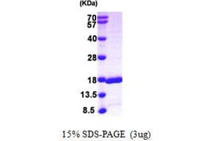 SDS-PAGE (SDS) image for GABA(A) Receptor-Associated Protein-Like 2 (GABARAPL2) (AA 1-117) protein (His tag) (ABIN667864)