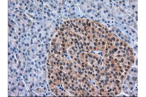 Immunohistochemical staining of paraffin-embedded Human Kidney tissue using anti-TACC3 mouse monoclonal antibody.