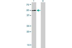 Western Blot analysis of LEF1 expression in transfected 293T cell line by LEF1 monoclonal antibody (M01), clone 3H5. (LEF1 anticorps  (AA 1-399))