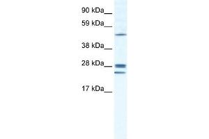 GJB2 antibody used at 1. (GJB2 anticorps  (N-Term))