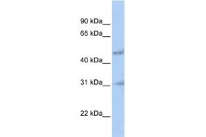 WB Suggested Anti-ABT1 Antibody Titration:  0. (Activator of Basal Transcription 1 anticorps  (N-Term))