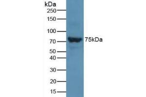 Detection of SLC27A5 in Rat Liver Tissue using Polyclonal Antibody to Solute Carrier Family 27 Member 5 (SLC27A5) (SLC27A5 anticorps  (AA 488-690))