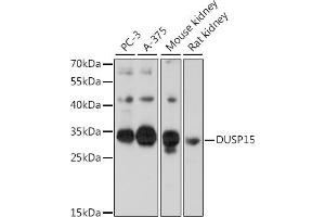 Western blot analysis of extracts of various cell lines, using DUSP15 antibody (ABIN7266846) at 1:1000 dilution.