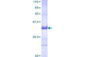 Image no. 1 for Ras and Rab Interactor 2 (RIN2) (AA 786-894) protein (GST tag) (ABIN1318085)