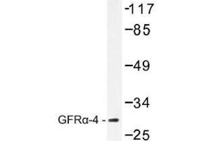 Image no. 1 for anti-GDNF Family Receptor alpha 4 (GFRA4) antibody (ABIN317910) (GFRA4 anticorps)
