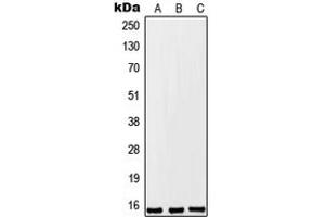 Western blot analysis of FKSG2 expression in A549 (A), Raw264. (FKSG2 anticorps  (Center))
