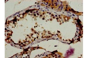 Immunohistochemistry of paraffin-embedded human testis tissue using ABIN7167841 at dilution of 1:100 (RBP1 anticorps  (AA 70-112))