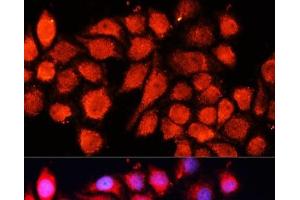 Immunofluorescence analysis of HeLa cells using MRPS28 Polyclonal Antibody at dilution of 1:100 (40x lens). (MRPS28 anticorps)