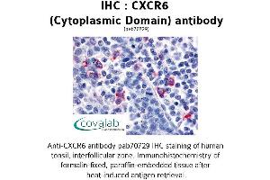 Image no. 1 for anti-Chemokine (C-X-C Motif) Receptor 6 (CXCR6) (2nd Cytoplasmic Domain) antibody (ABIN1733413) (CXCR6 anticorps  (2nd Cytoplasmic Domain))