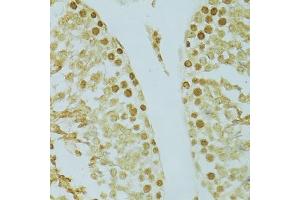 Immunohistochemistry of paraffin-embedded rat testis using RCC1 antibody (ABIN5973761) at dilution of 1/100 (40x lens). (RCC1 anticorps)