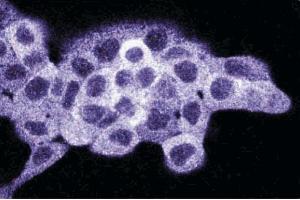 Immunofluorescence staining on A431 cells (Human epithelial carcinoma, ATCC CRL-1555). (Dynamin 1-Like anticorps  (AA 19-201))