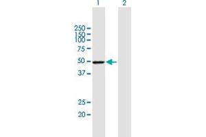 Western Blot analysis of PSMD4 expression in transfected 293T cell line by PSMD4 MaxPab polyclonal antibody. (PSMD4/ASF anticorps  (AA 1-377))