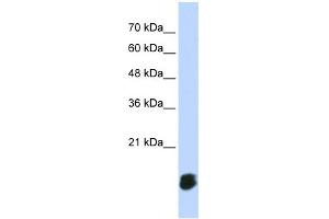 WB Suggested Anti-GLRX5 Antibody Titration: 0. (GLRX5 anticorps  (Middle Region))